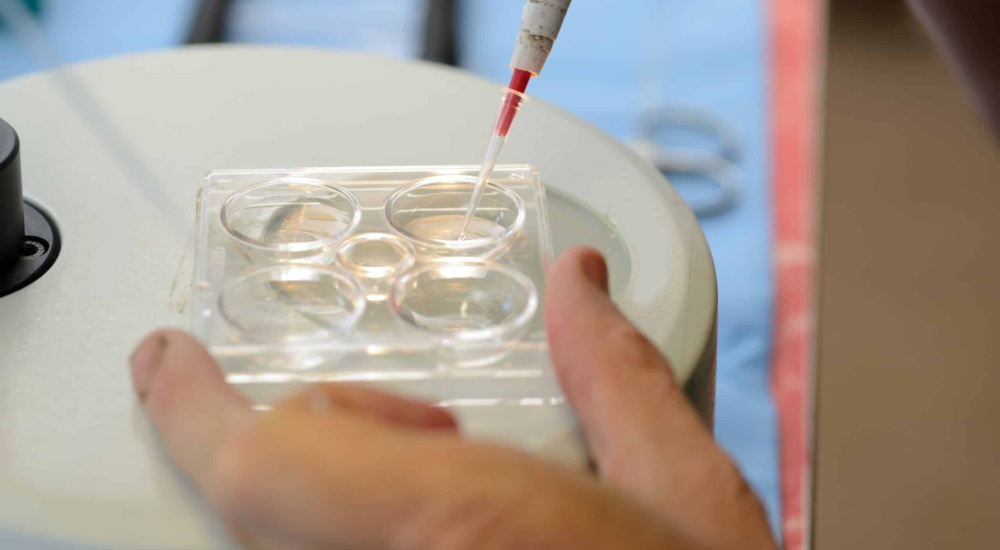 In vitro embryo production